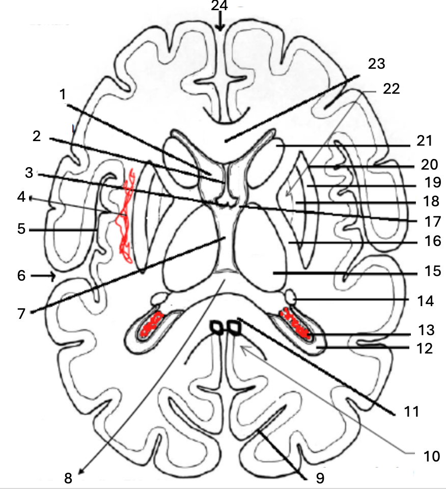 <p>Fissure longitudinale médiane</p>