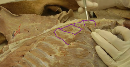 <p>Serratus Dorsalis (Thoracic wall)</p>