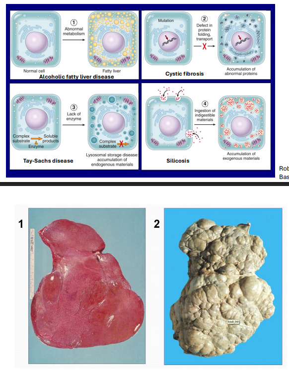 <p>Intracellular Accumulations</p>