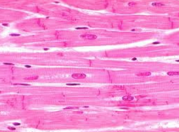 <p>Identify this tissue type.</p>