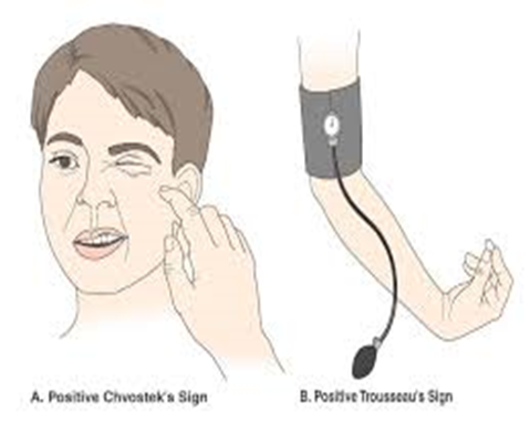 <p>lack of intake, lack of weight bearing activity, hypothyroid dysfunction, signs:</p><ul><li><p>seizures</p></li><li><p>tetany</p></li><li><p>spasms</p></li><li><p>cognitive dysfunction</p></li><li><p>dysrhythmias/hypotension if profound</p></li></ul><p></p>