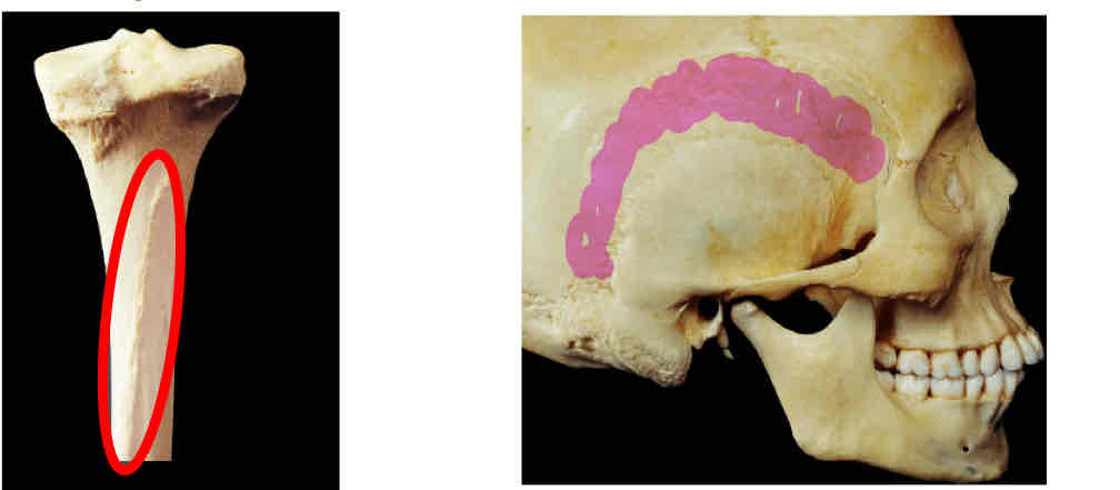 <p>Identify this </p>