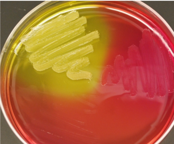 <p>what plate is this </p>