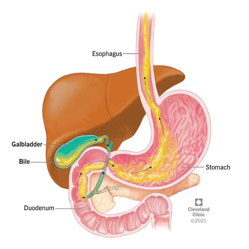 <ul><li><p>Formed by the liver</p></li><li><p>fluid that is made and released by the liver and stored in the gallbladder</p></li></ul>