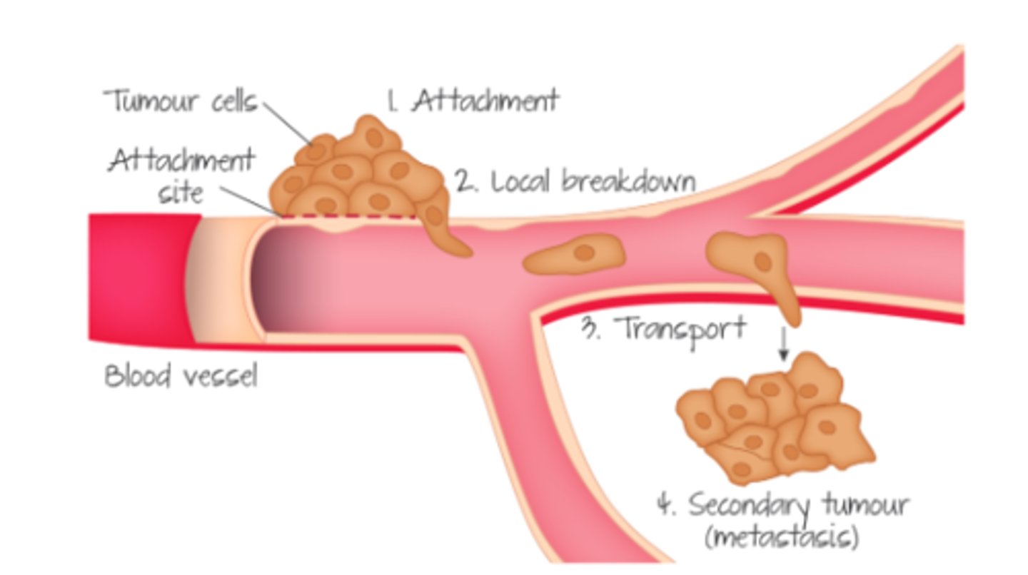 <p>secondary tumours</p>