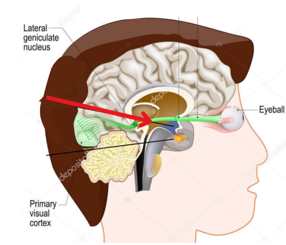 term image