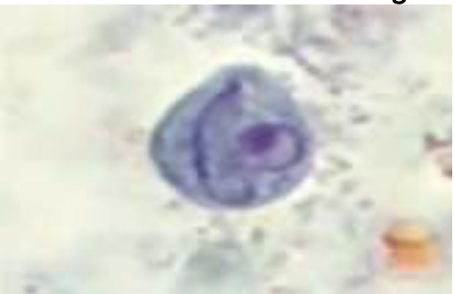 cyst or trophozoite: 

* under the stained smear, the remnant of the flagella in the cytoplasm and the nucleus is very prominent 