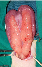 <p>Fat —&gt; increases with age </p>