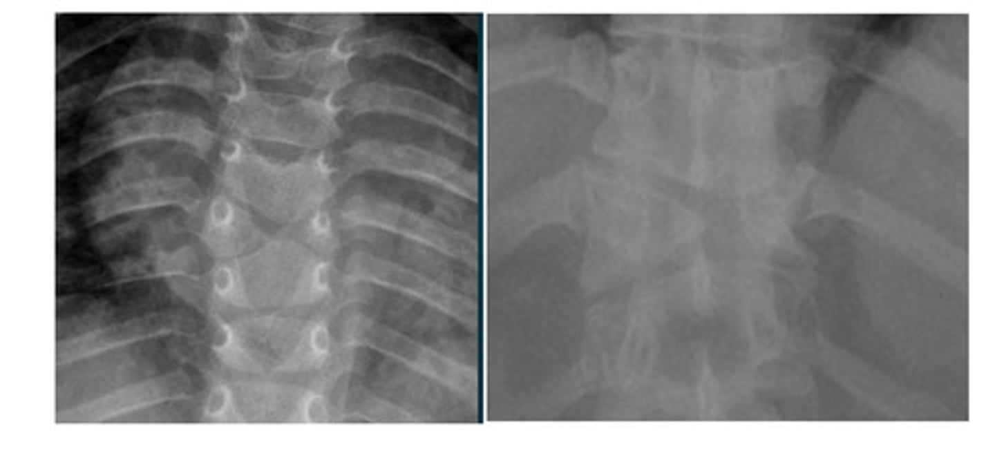 <p>What anomaly is this?</p>