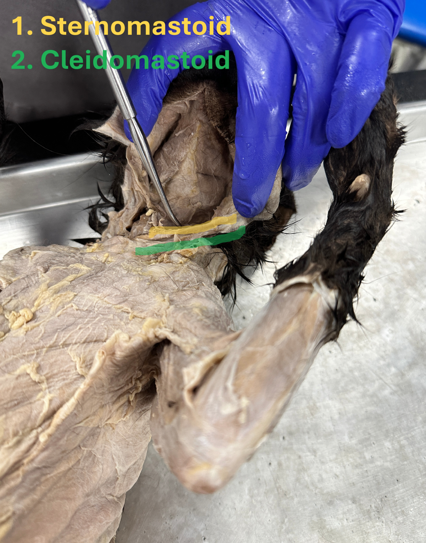 <p>Sternomastoid (neck muscle)</p>