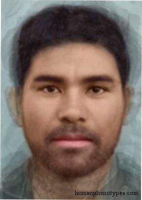 <p>Identify this Phenotype</p>