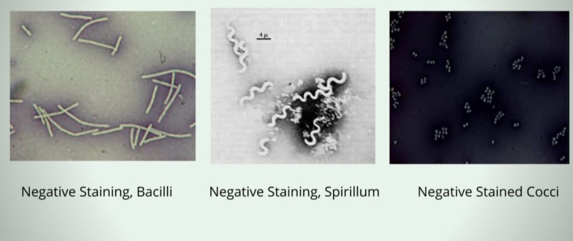 <p>Where are negative stain slides disposed of?</p>
