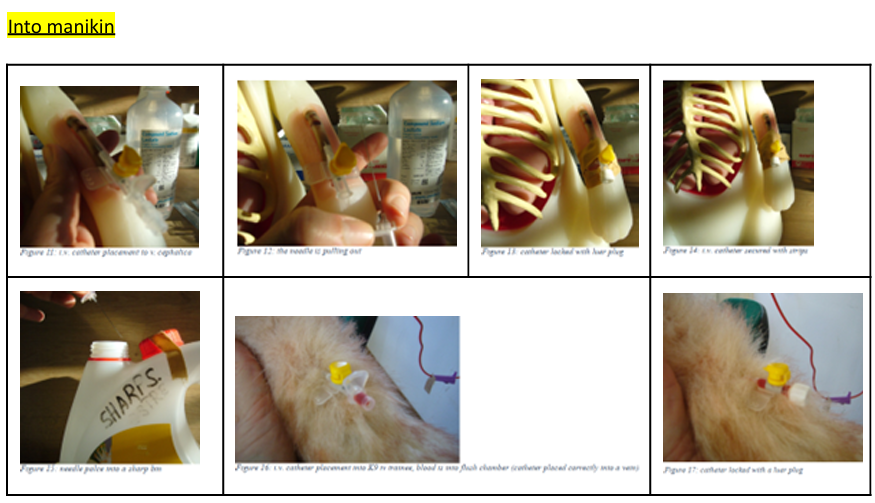 <p class="text-primary-foreground"><strong>Intubation:</strong> procedure during anesthesia/surgery/other to maintain an open airway, allowing for delivery of O2 and anesthetic gases while protecting the airway from aspiration.</p><ul><li><p class="text-primary-foreground">Laryngoscope is used to visualize the larynx, and place an endotracheal tube into trachea. The ET tube is then attached to ventilator/anesthetic machine to give O2/anesthesia. Monitor vitals throughout procedure. ET is removed once animal is awake and able to breathe on their own.</p></li></ul><p><span style="color: purple"><strong>Equipment Needed</strong></span></p><ul><li><p>Appropriately sized endotracheal tubes (ET) - good to have one size smaller and larger available.</p></li><li><p>5 mL syringe for cuff inflation</p></li><li><p>Sterile lubricant</p></li><li><p>Gauze pads</p></li><li><p>Mouth gag</p></li><li><p>Gauze to tie in ET</p></li><li><p>Laryngoscope</p></li><li><p>Topical anesthetic solution (for cats)</p></li><li><p>Cotton applicator sticks (for topical anesthetic application)</p></li><li><p>Stylet (for small ET tubes)</p></li></ul><p><span style="color: purple"><strong>Procedure</strong></span></p><ol><li><p class="text-primary-foreground"><strong>Select and prepare the ET tube</strong>:</p><ul><li><p>Measure appropriate length and diameter</p></li><li><p>Check cuff inflation and tube cleanliness</p></li><li><p>Apply minimal sterile lubricant to the tip</p></li></ul></li><li><p class="text-primary-foreground"><strong>Position the patient</strong> (typically in sternal recumbency)</p></li><li><p class="text-primary-foreground"><strong>Insert the tube</strong>:</p><ul><li><p>Place mouth gag</p></li><li><p>Gently extend the tongue with gauze pad</p></li><li><p>Depress the epiglottis with laryngoscope or tube tip</p></li><li><p>Pass the ET tube through the glottis until the tip is before the thoracic inlet</p></li></ul></li><li><p class="text-primary-foreground"><strong>Verify placement</strong>: Auscultate both sides of the chest for bilateral breath sounds, palpate the neck to confirm tube position.</p></li><li><p><strong>Secure the tube</strong>:</p><ul><li><p>Tie gauze around the tube behind the adapter (midway on the gauze), place gauze behind canine teeth, then tie around patient`s head, behind hears, to upper jaw.</p></li></ul></li><li><p class="text-primary-foreground"><strong>Connect and inflate</strong>: (lie patient on its side)</p><ul><li><p>Connect to anesthesia machine or ventilator</p></li><li><p>Inflate cuff with air (≤3 mL for cats, ≤6 mL for dogs) If it takes more air, then consider replacing with larger tube.</p></li></ul></li></ol><p><span style="color: green"><strong>Intravenous Cannulation: </strong></span>provides direct access to the bloodstream for giving fluids, meds and emergency drugs.</p><p><span style="color: green"><strong>Equipment Needed</strong></span></p><ul><li><p>IV catheter</p></li><li><p>Clippers</p></li><li><p>Heparinized saline</p></li><li><p>Chlorhexidine surgical scrub</p></li><li><p>Alcohol</p></li><li><p>Swabs/cotton wool</p></li><li><p>Adhesive tape</p></li><li><p>Padding bandage</p></li><li><p>Cohesive bandage</p></li></ul><p><span style="color: green"><strong>Procedure of placing IV cannulation (real life):</strong></span></p><ol><li><p class="text-primary-foreground"><strong>Prepare the site</strong>:</p><ul><li><p>Restrain the patient appropriately</p></li><li><p>Clip hair over the selected vein</p></li><li><p>Clean with chlorhexidine followed by alcohol</p></li><li><p>Maintain strict aseptic technique throughout - poor can lead to phlebitis (irritation)</p></li></ul></li><li><p class="text-primary-foreground"><strong>Insert the catheter</strong>:</p><ul><li><p>Have an assistant raise the vein</p></li><li><p>Insert the catheter through the skin and into the vein</p></li><li><p>Confirm placement by observing blood return in the catheter hub</p></li></ul></li><li><p class="text-primary-foreground"><strong>Advance and secure</strong>: hold stylet stationary while advancing the catheter into the vein</p><ul><li><p class="text-primary-foreground">Ask assistant to stop raising and press over the vein a few cm above catheter entry site (prevents contamination of the leg with blood when stylet is removed).</p></li><li><p>Remove the stylet and cap the catheter</p></li><li><p>Flush with heparinized saline to confirm placement</p></li></ul></li><li><p class="text-primary-foreground"><strong>Bandage securely</strong>:</p><ul><li><p>Apply adhesive tape to stabilize the catheter</p></li><li><p>Place a protective bandage using padding and cohesive materials</p></li></ul></li></ol><img src="https://knowt-user-attachments.s3.amazonaws.com/e13f765a-8973-41c1-bb18-692298f451be.png" data-width="50%" data-align="center"><img src="https://knowt-user-attachments.s3.amazonaws.com/9e88a82b-e907-4741-a7e0-aa202005b82a.png" data-width="50%" data-align="center"><p></p>
