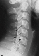 <p>Q what is the name of this measurement? and what is the average + range?</p>
