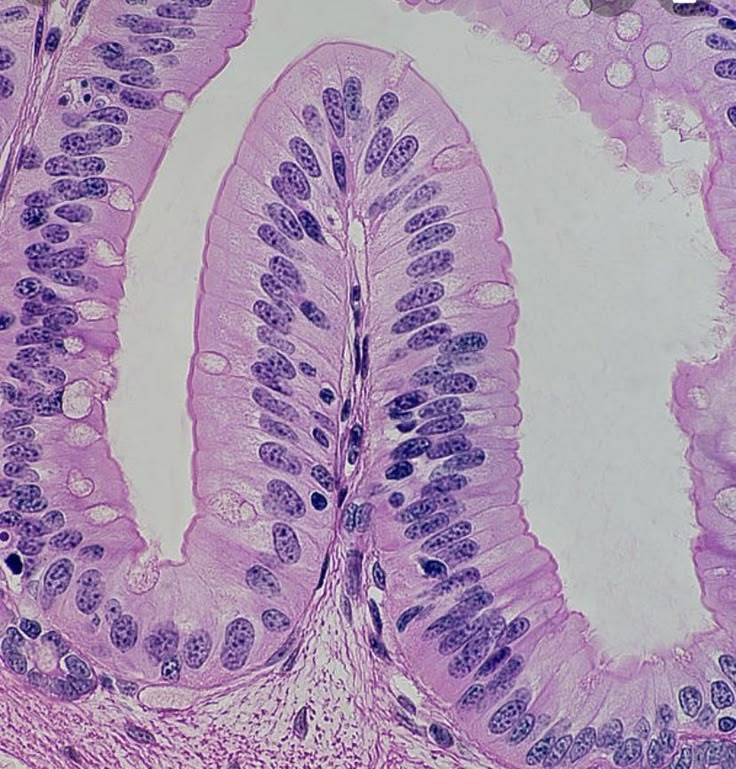 <p>what type of tissue is this (subtype and type)</p>