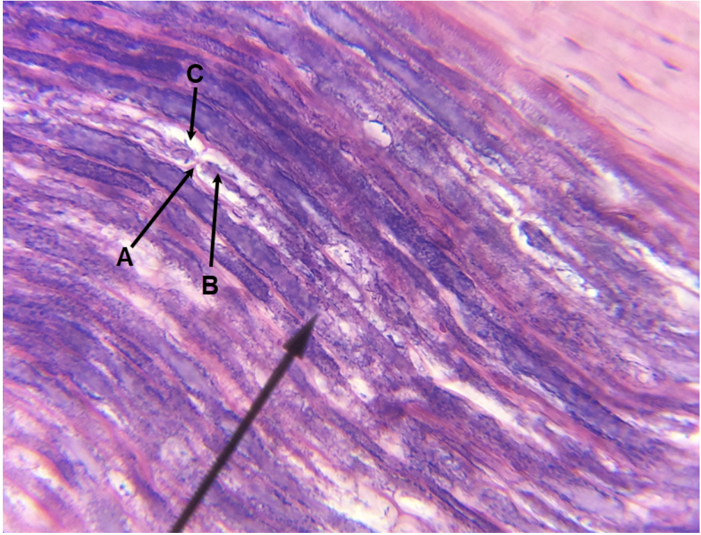 <p><span><span>In the image above, identify structures A-C. (Hint: B is purple, C is white.)</span></span></p>