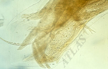 <p>What is the genus species and segment of this parasite?</p>
