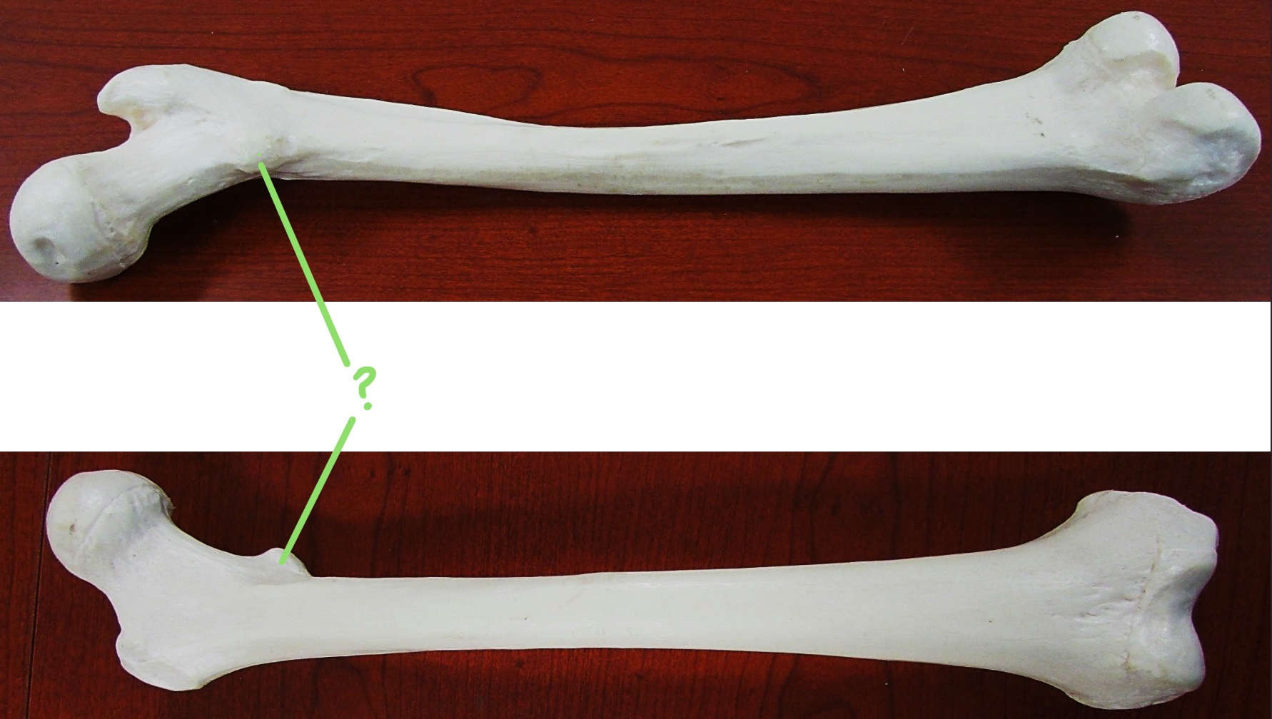 <p>Determine the part of the Femur highlighted</p>