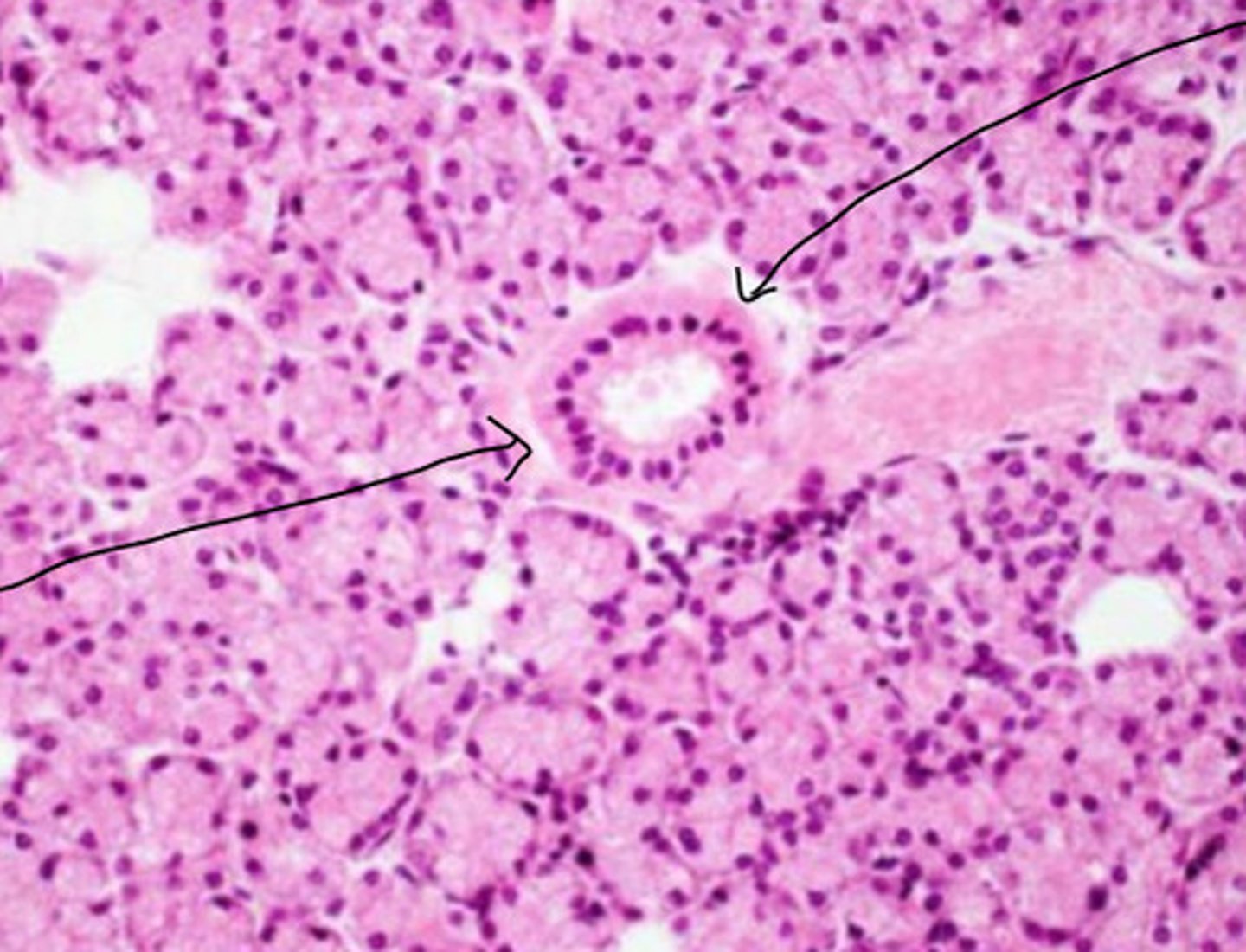 <p>ID the Histology</p>