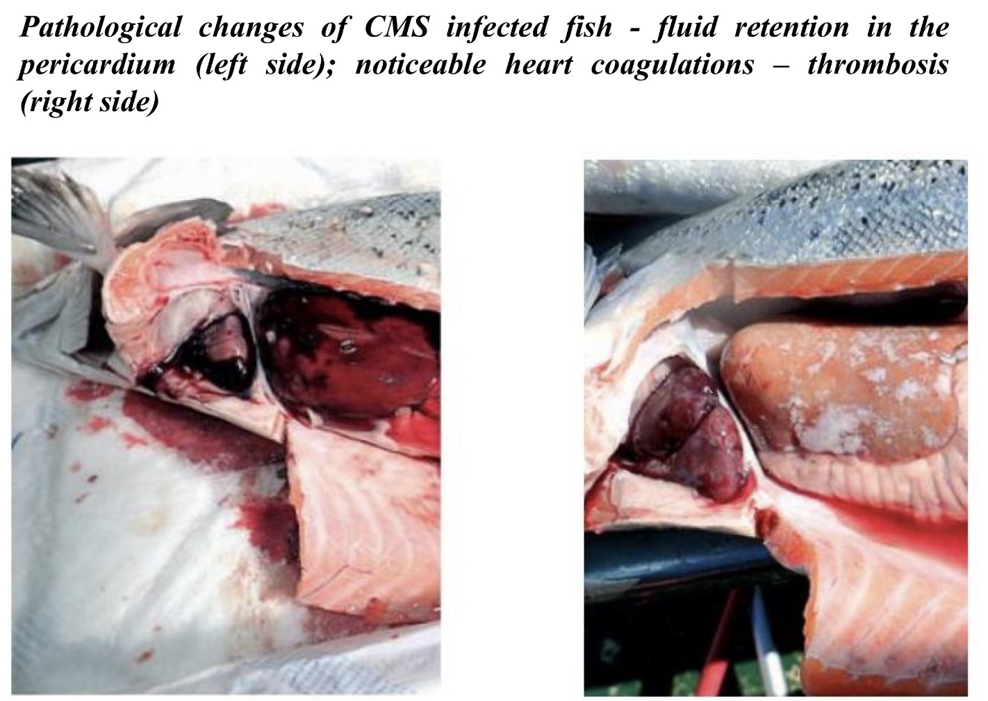 <p><strong>Causative agent:</strong></p><ul><li><p><strong><mark data-color="red" style="background-color: red; color: inherit;">Piscine myocarditis virus</mark> (PMC virus)</strong></p></li></ul><p></p><p><strong>Susceptible hosts</strong></p><ul><li><p><strong>Farmed Atlantic salmon - common in Trøndelag, Norway</strong></p></li><li><p>Especially:</p><ul><li><p>Fish at <strong>slaughter weight</strong> in sea</p></li><li><p>Young salmon <strong>recently transferred to saltwater</strong></p></li></ul></li><li><p><strong>Stress</strong> can trigger outbreaks</p></li></ul><p></p><p><strong>Transmission</strong></p><ul><li><p><strong>Horizontal:</strong> fish-to-fish</p></li></ul><p></p><p><strong>Clinical signs</strong></p><ul><li><p>Often <strong>absent, </strong>CMS evolves slowly and it can take a while before fish shows sign of disease</p></li><li><p>Occasionally <strong>sudden death</strong> without warning</p></li></ul><p></p><p><strong>Pathological changes</strong></p><ul><li><p><strong>Circulatory disturbances</strong></p></li><li><p><strong>Atrial lesions / degeneration</strong></p></li><li><p><strong>Pericardial effusion</strong> (fluid in pericardium)</p></li><li><p><strong>Heart coagulations / myocardial necrosis</strong></p></li></ul><p></p><p><strong>Prevention & Therapy</strong></p><ul><li><p><strong>No vaccine</strong> available</p></li><li><p>Management: reduce <strong>stress</strong>, good biosecurity</p></li></ul><p></p><p><strong>Diagnosis</strong></p><ul><li><p><strong>Histology</strong>: myocardial degeneration, atrial lesions</p></li><li><p>Some dead fish may show <strong>no gross lesions</strong>, so careful tissue sampling needed</p></li></ul><p></p><p><strong>One-sentence oral exam answer</strong></p><figure data-type="blockquoteFigure"><div><blockquote><p>“Cardiomyopathy syndrome is a viral disease of farmed Atlantic salmon caused by PMC virus, transmitted horizontally, often asymptomatic, but can cause sudden death with characteristic atrial lesions and pericardial fluid.”</p></blockquote><figcaption></figcaption></div></figure><p></p><p><strong>Exam memory tip</strong></p><ul><li><p><strong>CMS = heart disease + sudden death + stress trigger</strong></p></li><li><p>Often <strong>no clinical signs until dead fish</strong></p></li></ul><p></p>