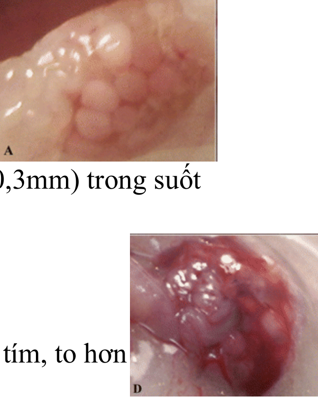 <p><span style="color: red;"><span>B. Thỏ cái (</span></span><span>♀</span><span style="color: red;"><span>)</span></span></p><p>Đặc điểm của thỏ cái:</p><p>_Chỉ rụng trứng khi có kích thích hoặc giao phối với thỏ đực</p><p><strong>Thí nghiệm</strong>:</p><p><strong>_Thỏ cái</strong>: buồng trứng <strong>không</strong> có nang chín</p><p>_Tiêm nước tiểu của người nghi có thai vào <strong>tĩnh mạch rìa tai</strong> thỏ (hCG: hormone qua đường máu)</p><p><strong>Kết quả</strong>:</p><p><strong>_(-)</strong>: trắng hồng, nang trứng lấm tấm, trong suốt</p><p><strong>_(+)</strong>: Nang trứng sung huyết, màu đỏ tím, to hơn</p><p><strong>Đơn vị thỏ</strong>:</p><p>_Lượng hCG tối thiểu trên thỏ cái nặng 2kg, sau 48h làm 1 nang trứng chín</p><p>_Tiêm 5ml huyết thanh/10ml nước tiểu vào TM rìa tai thỏ với nồng độ giảm dần</p>