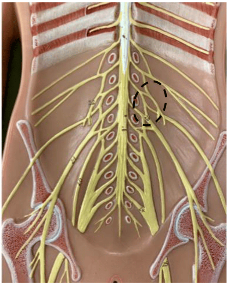 <p>One is hidden</p><p></p>