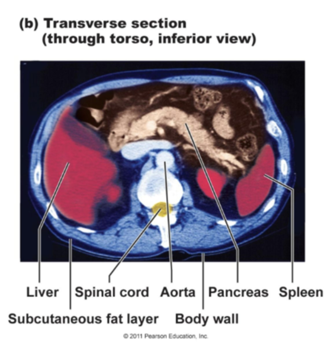 <p>The transverse plane is taken across the body.Often times used for brain or abdominal imaging.Can be taken at any level of the abdomen or multiple levels to yield a series.</p>