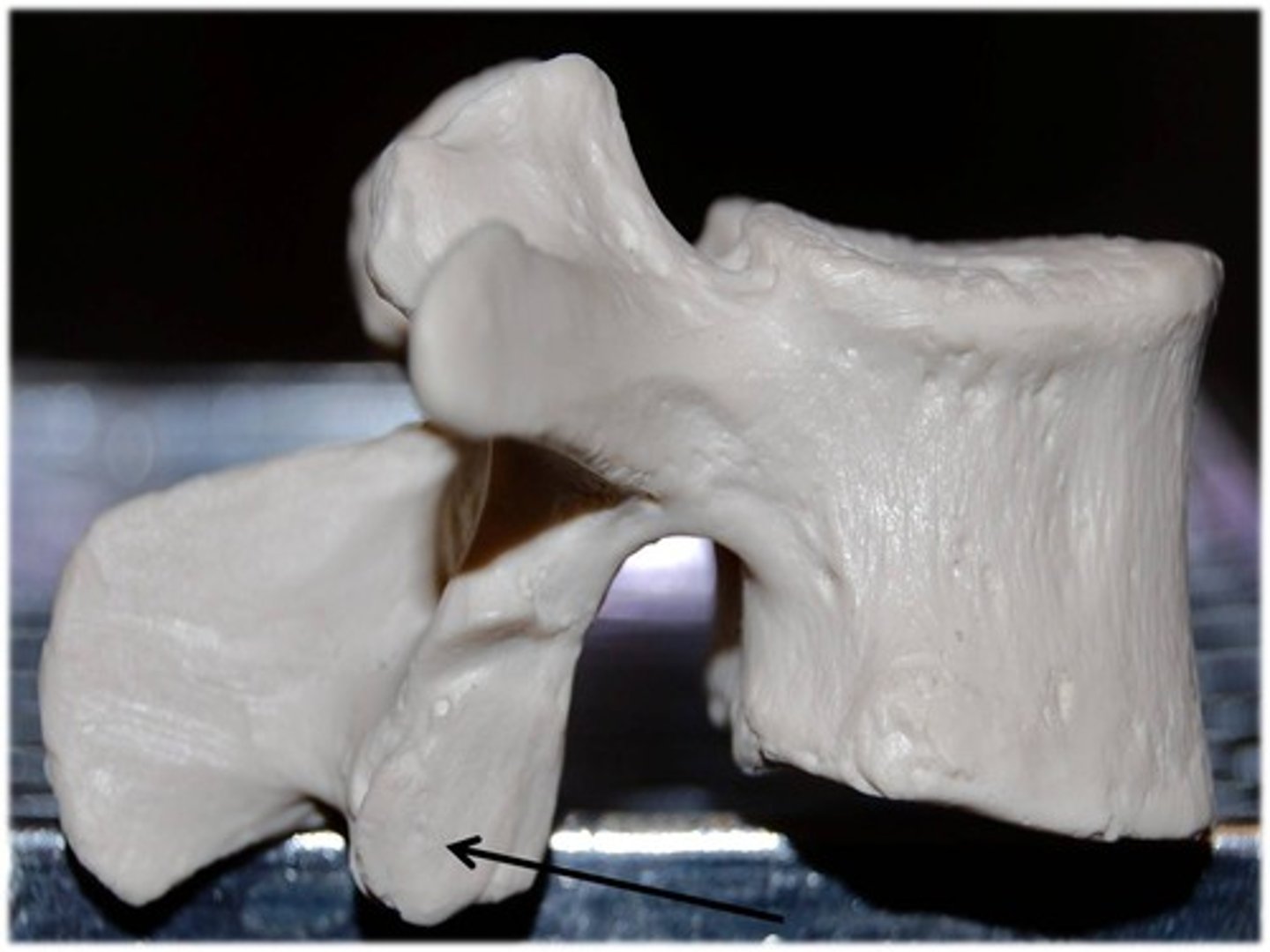 <p>allows vertebra to form joints with adjacent vertebrae; inferior part</p>