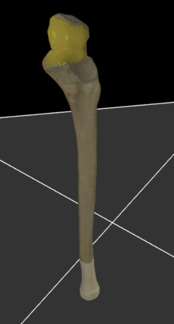 <p>De grote halve maanvormige gewrichtsoppervlakte op de voorzijde van de ulna dat om de trochlea humeri heen grijpt.</p>