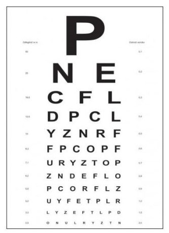 <p>zdolność rozdzielcza oka to</p>