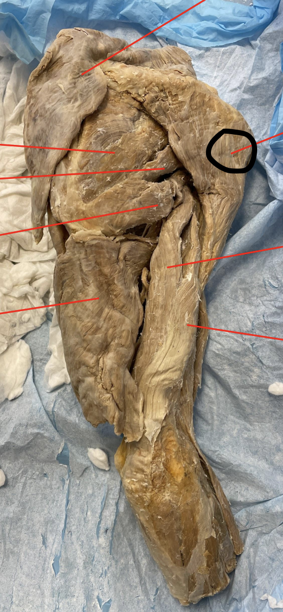 <p>identify + state origin, insertion, action, innervation of marked structure</p>