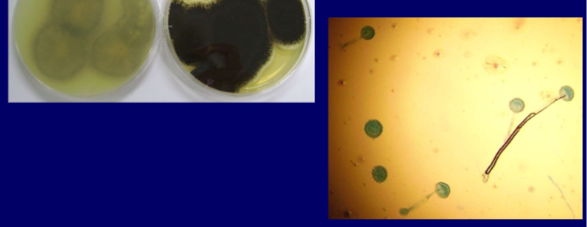 <p>Micro: globose/circular vesicle, globose conidia<br>Macro: whitw with black centres obverse, white yellow with furrows reverse</p>