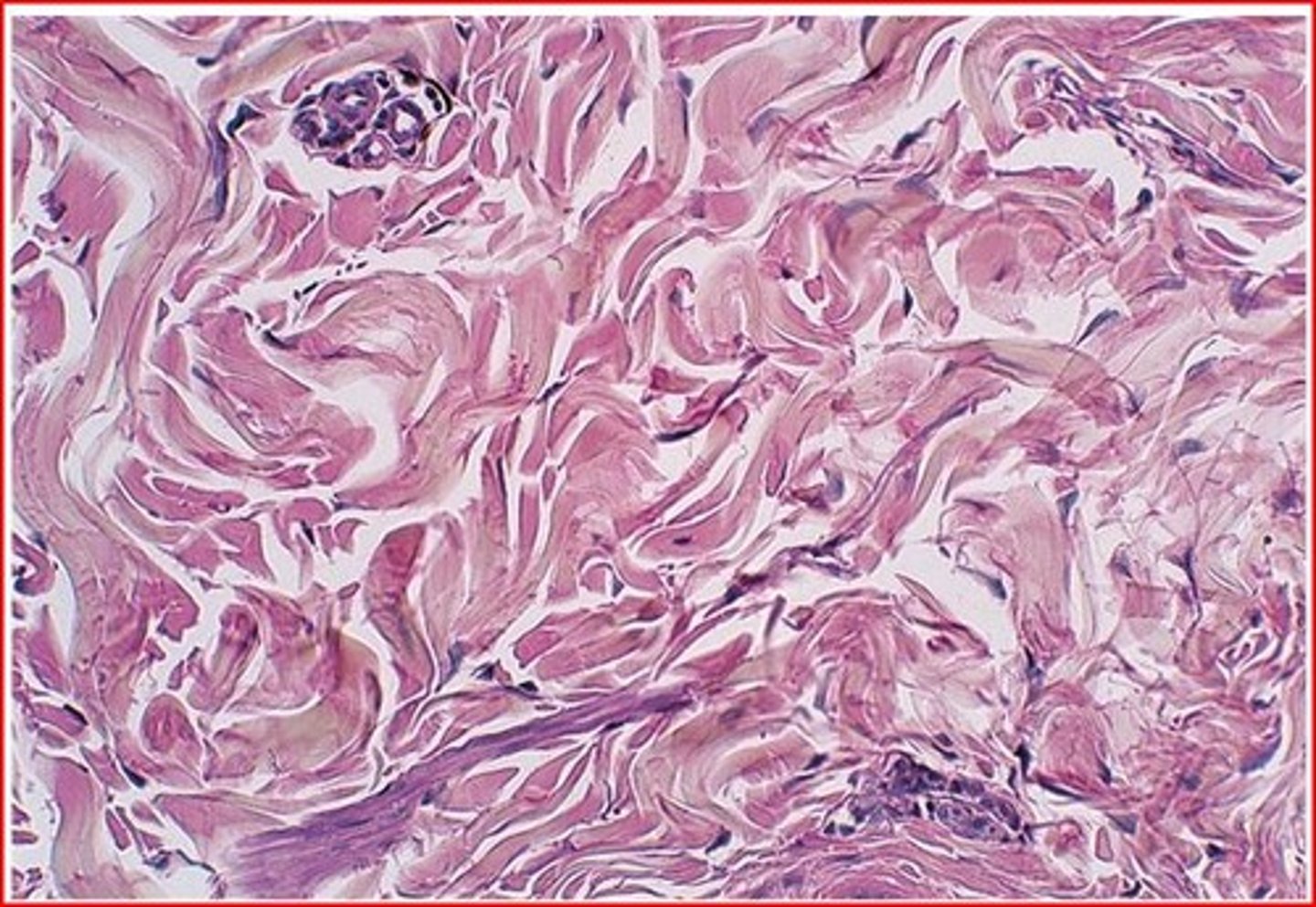 <p>irregularty arranged collaged fibers with few fibroblasts, withstands pulling in many directions</p>