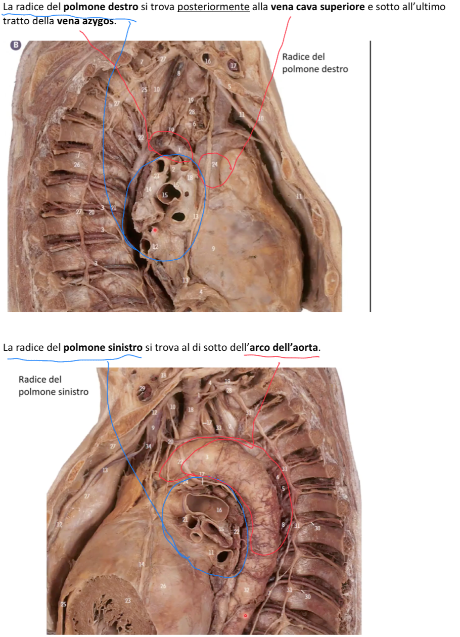 <p>LOCALIZZAZIONE PEDUNCOLI:</p><ul><li><p>Peduncolo Polmone Dx:</p><ul><li><p>E’ posteriore alla vena cava superiore e sotto la azygos</p></li></ul></li><li><p>Peduncolo Polmone Sx:</p><ul><li><p>E’ sotto l’arco aortico</p></li></ul></li></ul><p>(il peduncolo sono i rami, l’ilo è l’incavo)</p><p>ILO POLMONARE:</p><ul><li><p>Le strutture entrano ed escono dal polmone (che costituiscono il peduncolo) attraverso il suo ILO</p></li><li><p>Differenza chiave tra ilo destro e sinistro:</p><ul><li><p>A destra la struttura più alta è data dal bronco lobare superiore (che nasce prossimalmente l’ilo) e per questo è chiamato bronco epiarterioso</p></li></ul></li><li><p>Quindi i rapporti verticali dall’alto al basso sono:</p><ul><li><p>Polmone dx → bronco lobare superiore (che nasce prossimalmente l’ilo), arteria polmonare, vene polmonari</p></li><li><p>Polmone sx → arteria polmonare, bronco, vene polmonari</p></li></ul></li><li><p>Mentre i rapporti antero posteriori sono uguali a dx e sx:</p><ul><li><p>Vena polmonare, poi Arteria polmonare e poi bronchi.</p></li></ul></li></ul><p></p>
