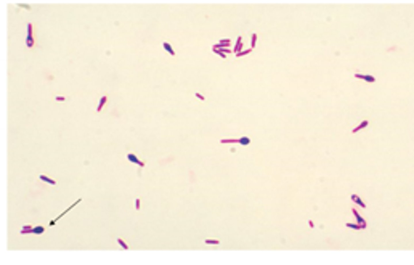 <p>· Reservoir: environment</p><p>· Infections: wound botulism, infant botulism, flaccid paralysis, potential mortality due to diaphragm deficit covert bioterrorism</p><p>· Don’t give babies unpasteurized honey</p>