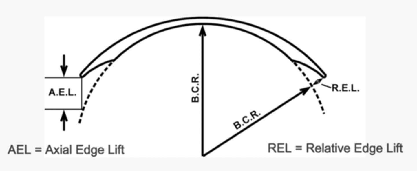<p>1. axial edge lift</p><p>2. relative edge lift</p><p>not evaluated clinically</p>