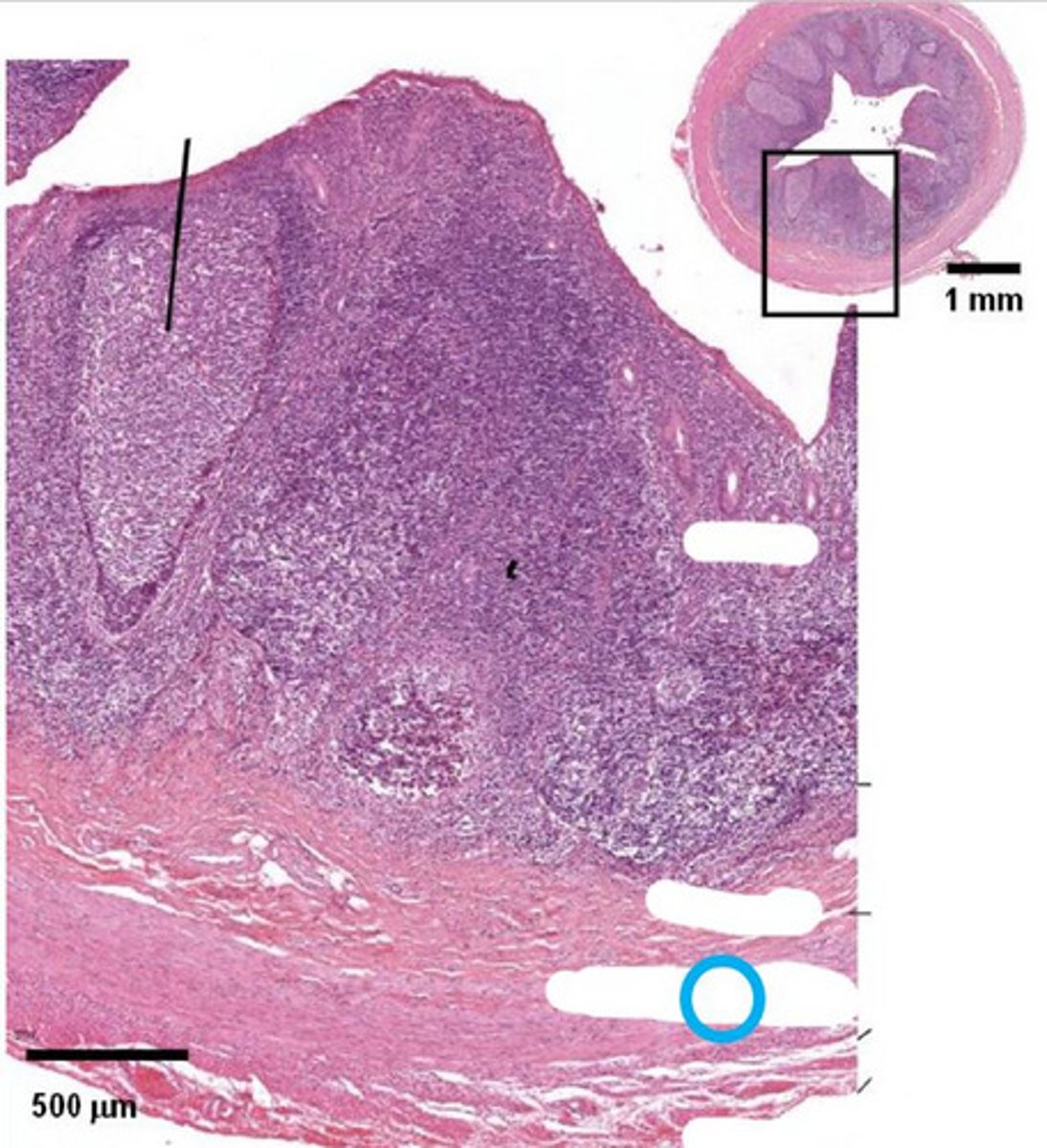 <p>smooth muscle</p>