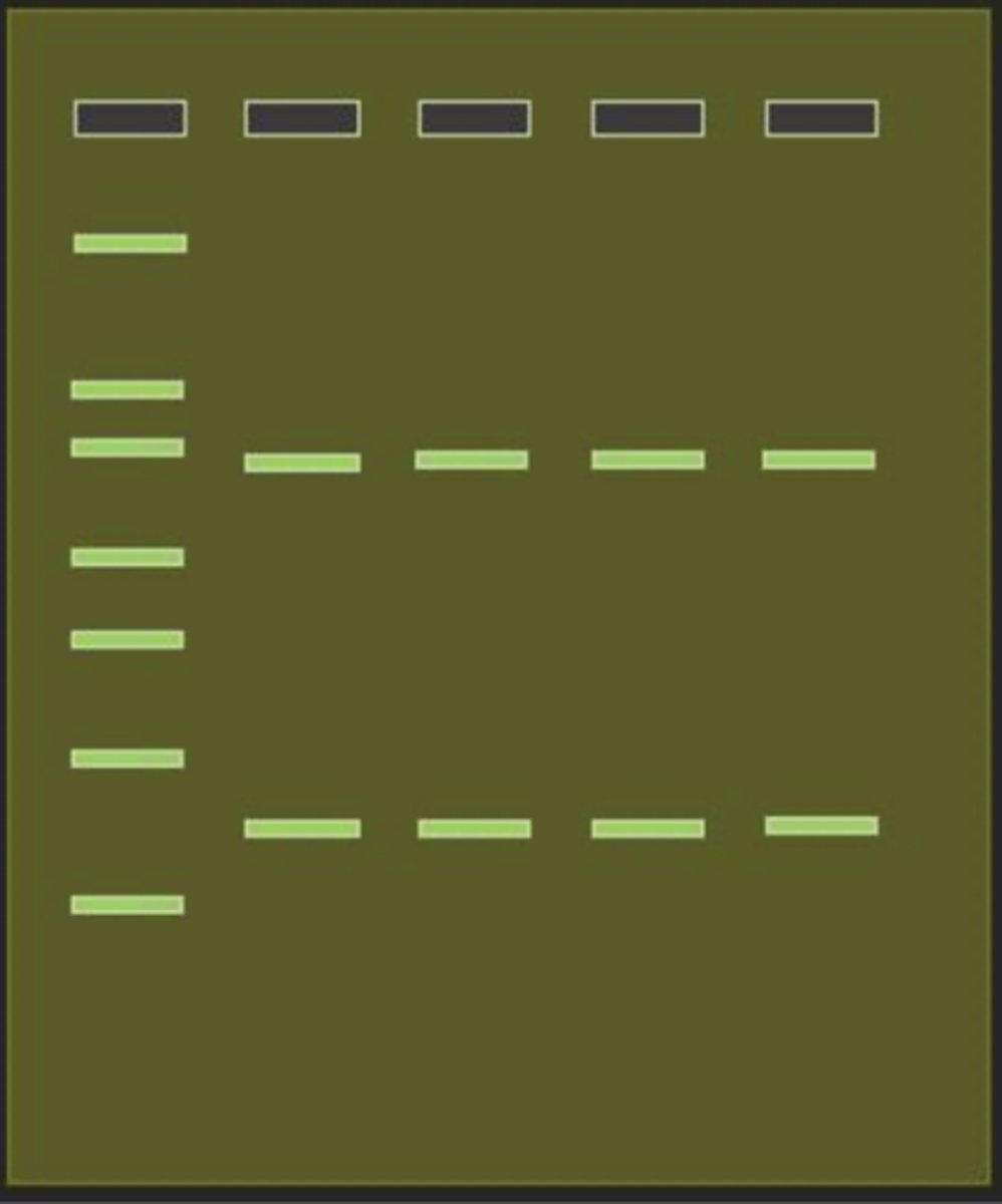 <p>A forensic scientist has just finished running PCR to amplify DNA segments from four different blood samples. They run the samples on an agarose gel, along with a ladder in the first lane, and to get the following results. Based on what you know about gel electrophoresis, how would you interpret these results?</p><p>a. The PCR product was unstable at room temperature and split into two pieces</p><p>b. PCR failed for all four samples</p><p>c. Two different primer pairs were used when the DNA was amplified</p><p>d. Too much ladder was added and it spilled over into the other wells</p>