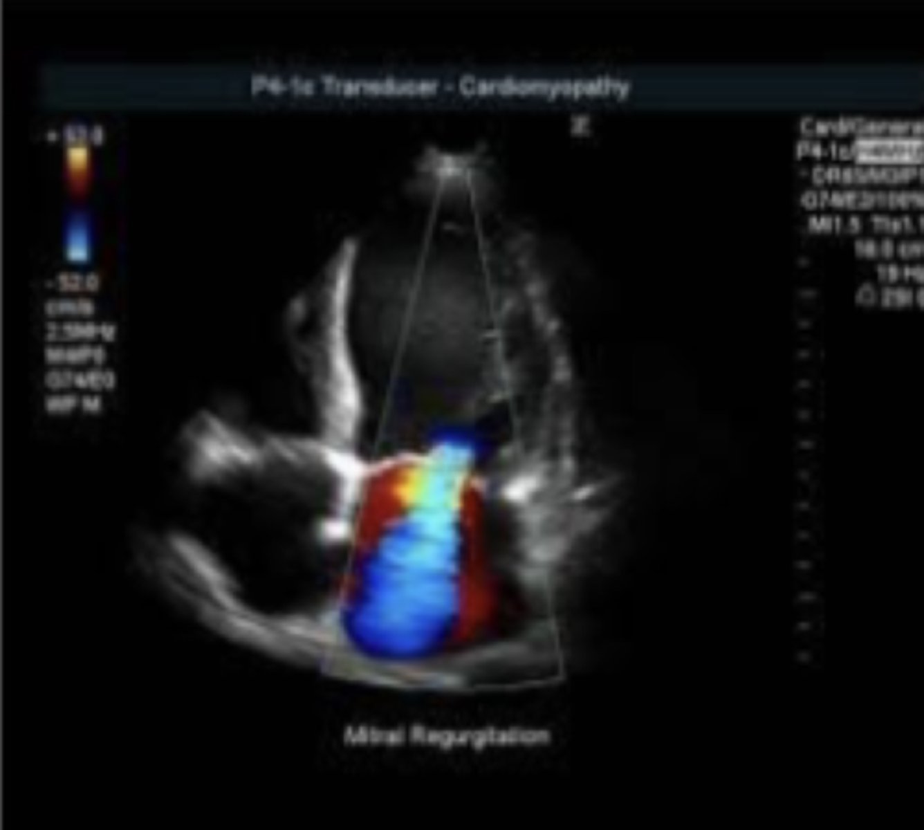 <p>¿para qué utilizamos ecocardiografía Doppler?</p>