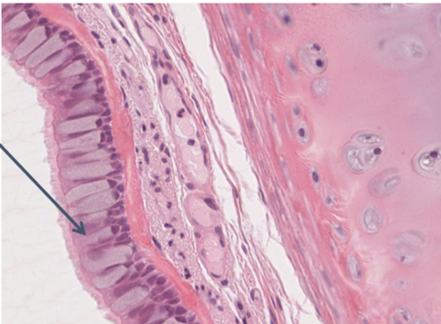 <p>What is the name of this type of epithelium</p>