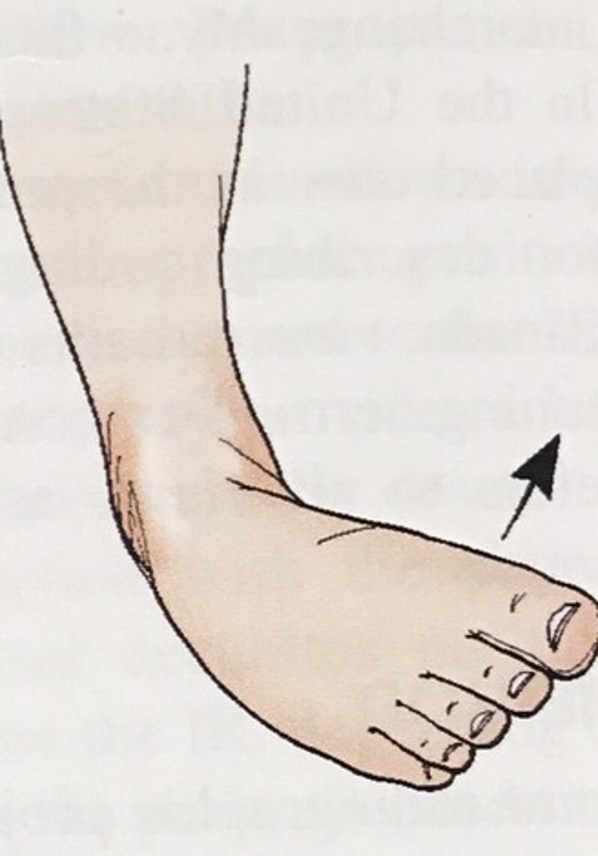 <p>inward turning of the foot at the ankle</p>