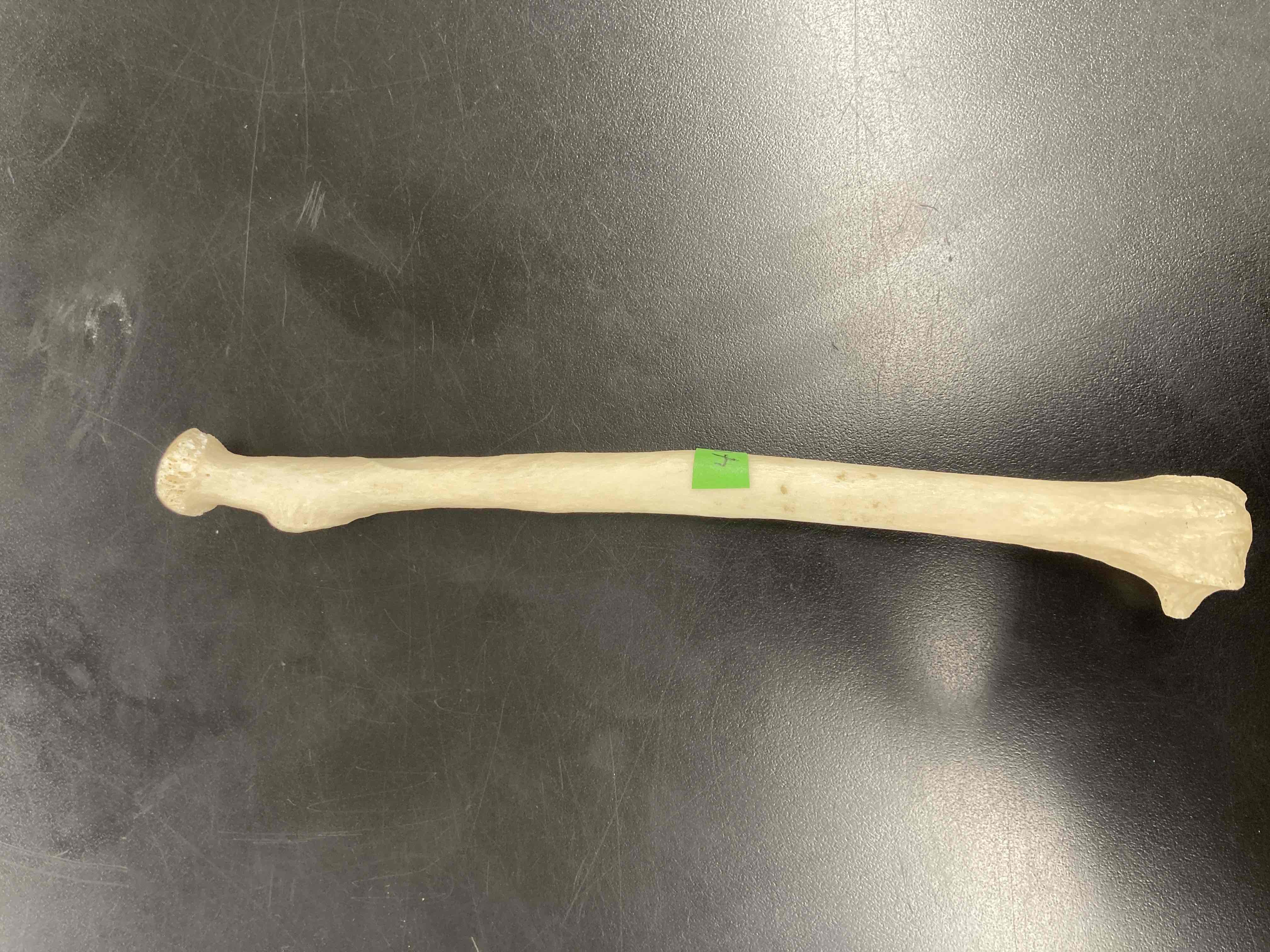 <p>What is the name of this bone?</p>