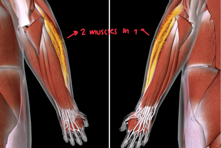 <p>Function: <strong>EXTEND</strong> and <strong>ABDUCT WRISTS </strong></p>
