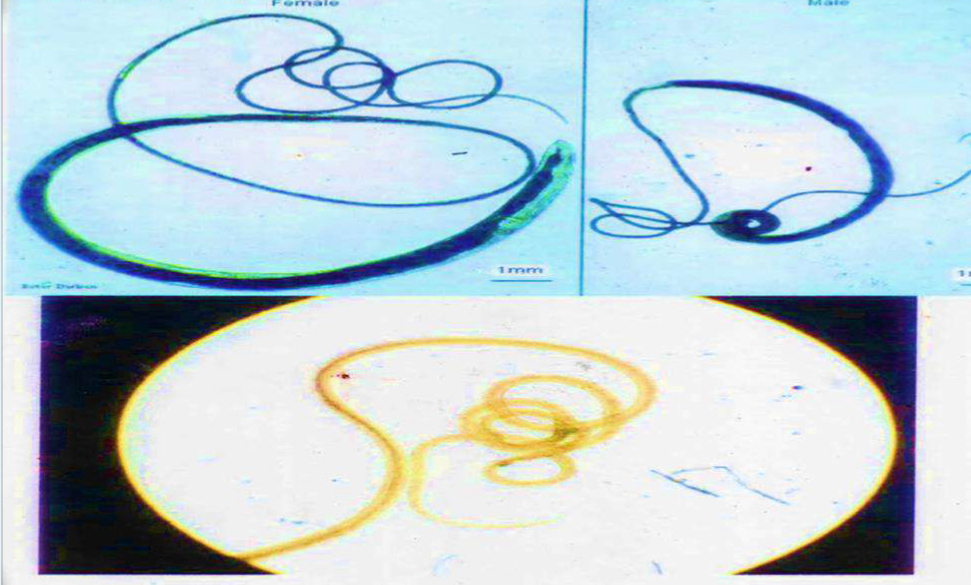 <p>Parasite under microscope </p>