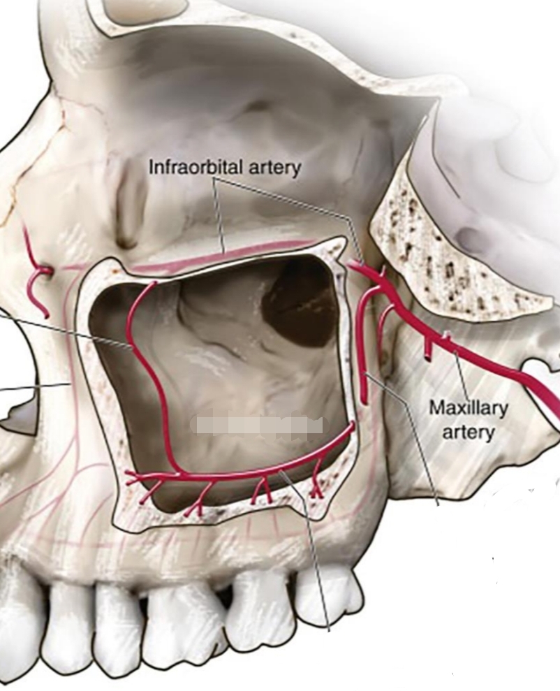 <p>2 air-filled cavities located on lateral sides of nose, above maxillary premolars and molars</p>