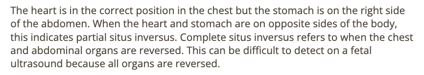 <p>c) partial sinus inversus </p>