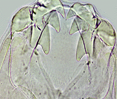 <ul><li><p><span style="color: red;"><strong>&lt;75µm</strong></span></p></li><li><p><span style="color: red;"><strong><u>Ancylostoma caninum</u></strong></span></p></li><li><p><span style="color: red;"><strong>Hookworm</strong></span></p></li></ul><p></p>