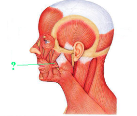 <p><span>Identify the indicated muscle.</span></p>