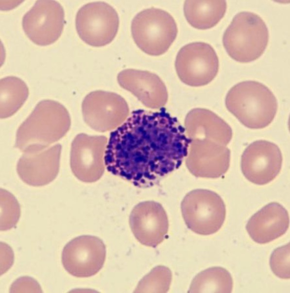 <p>What is this leukocyte?</p>