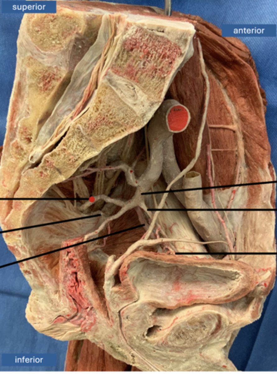 <p>artery</p>